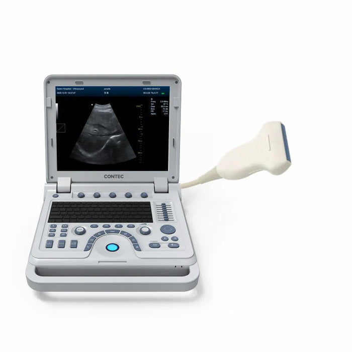 CMS1700B Portable Color Ultrasound Scanner - Asclepius