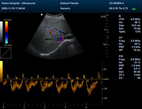 CMS1700B Portable Color Ultrasound Scanner - Asclepius