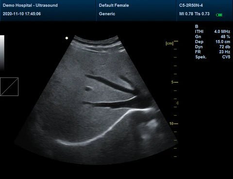 CMS1700B Portable Color Ultrasound Scanner - Asclepius