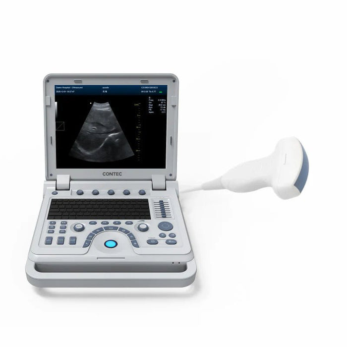 CMS1700B Portable Color Ultrasound Scanner - Asclepius