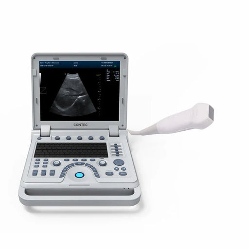 CMS1700B Portable Color Ultrasound Scanner - Asclepius