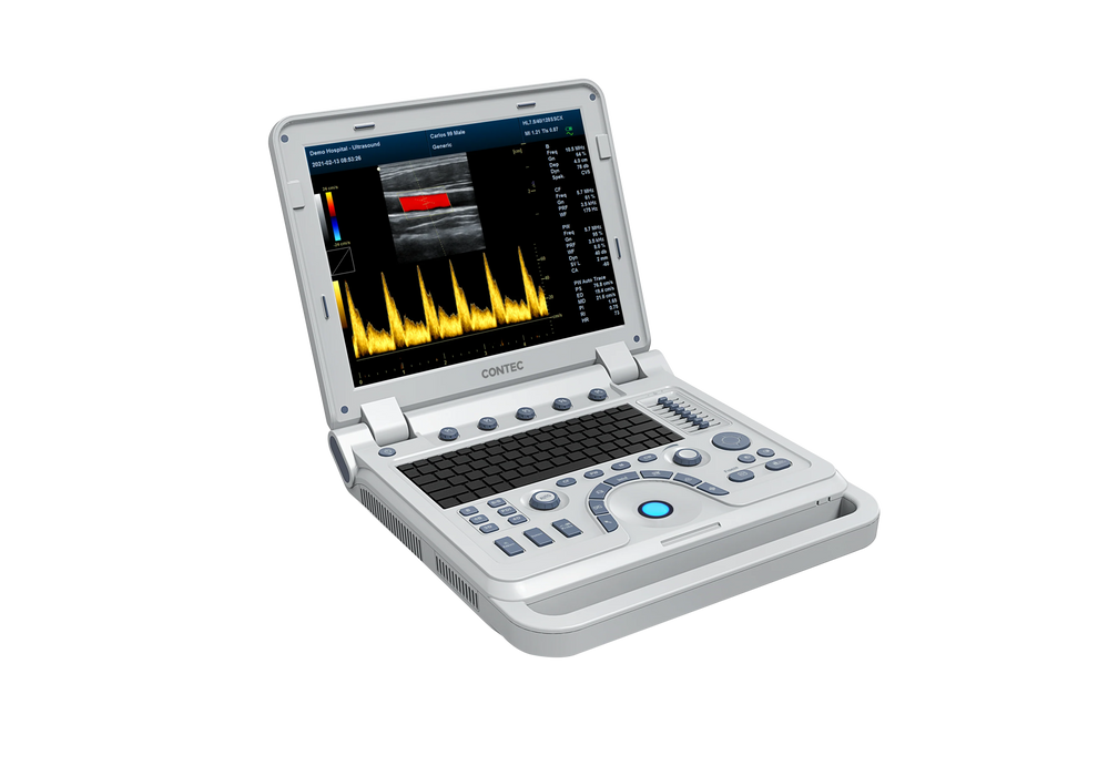 CMS1700B Portable Color Ultrasound Scanner - Asclepius