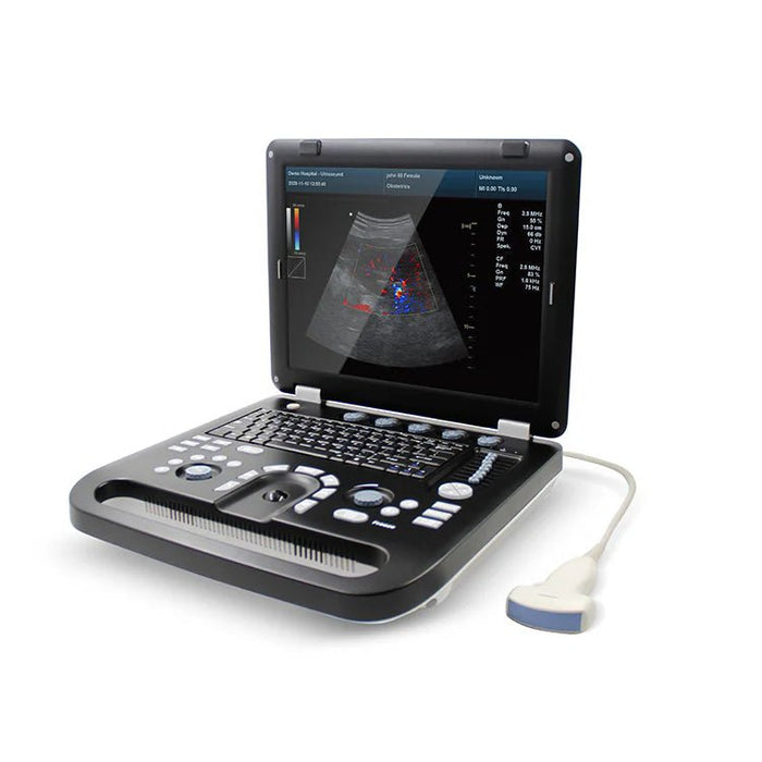 CMS1700C Portable Color Ultrasound Scanner - Asclepius