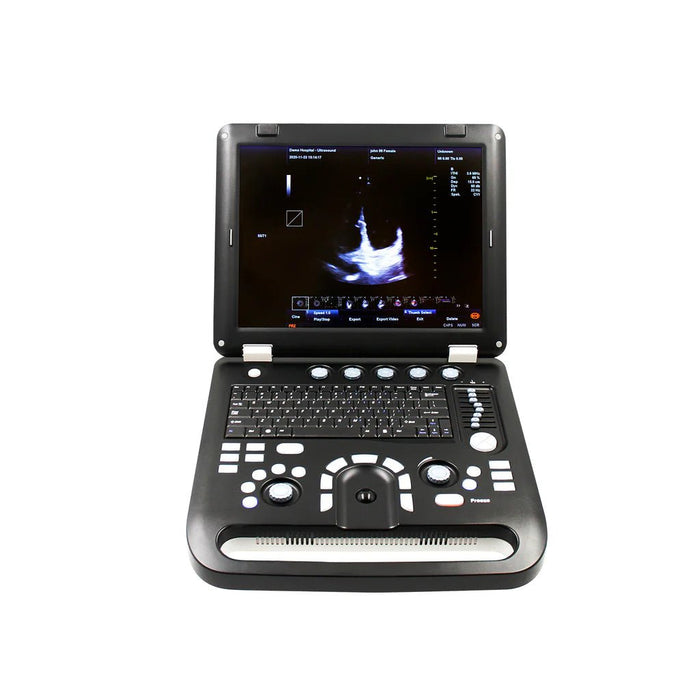 CMS1700C Portable Color Ultrasound Scanner - Asclepius