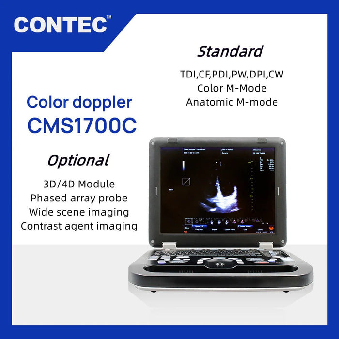 CMS1700C Portable Color Ultrasound Scanner - Asclepius