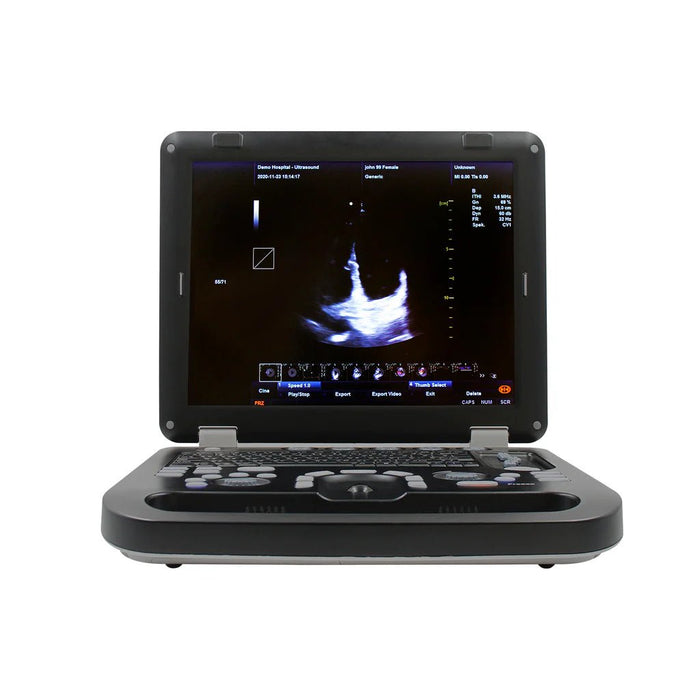 CMS1700C Portable Color Ultrasound Scanner - Asclepius