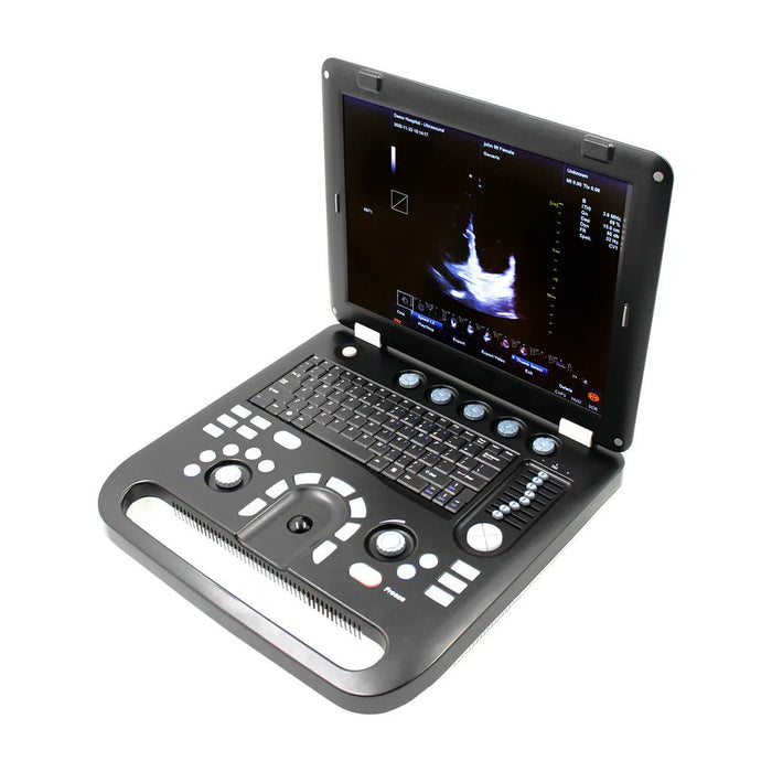 CMS1700C Portable Color Ultrasound Scanner - Asclepius