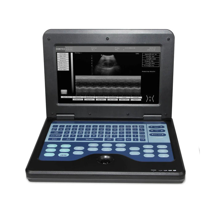 CONTEC CMS600P2 Portable Ultrasound - Asclepius