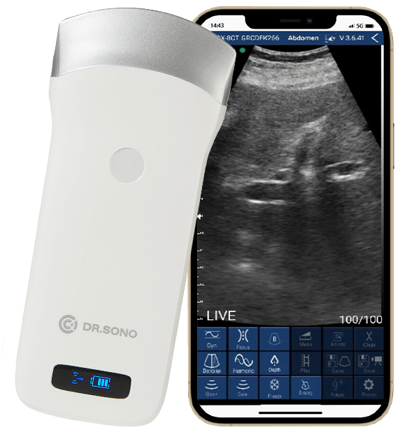 Convex Pro Portable Ultrasound Scanner – HD Imaging, Wireless, 3 - in - 1 Probe, Compatible with Windows, Android, iOS - Asclepius