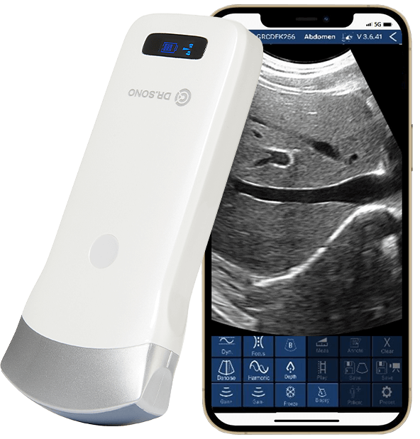 Convex Pro Portable Ultrasound Scanner – HD Imaging, Wireless, 3 - in - 1 Probe, Compatible with Windows, Android, iOS - Asclepius