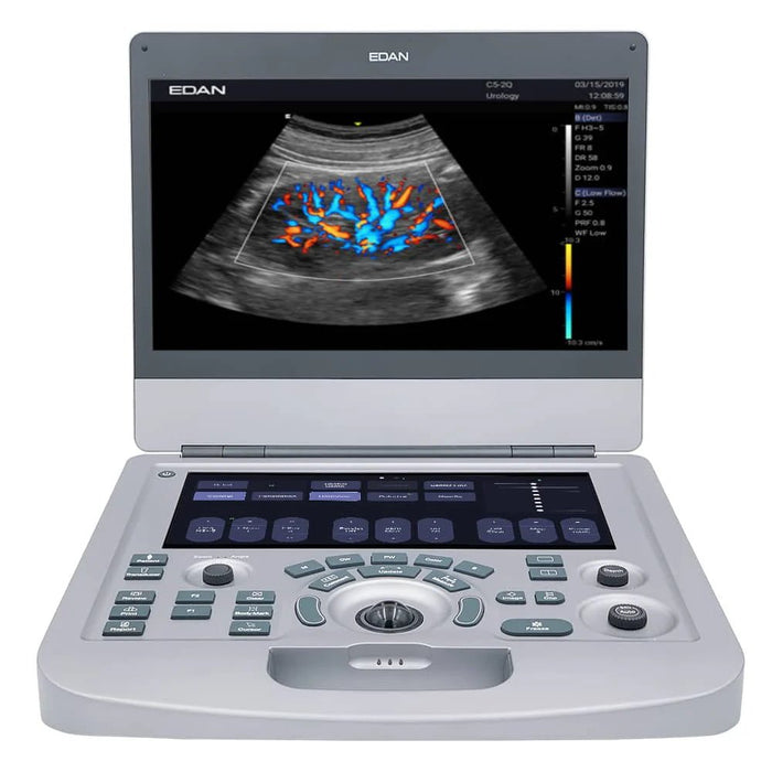 Edan Acclarix AX3 Compact Color Doppler Ultrasound System - Asclepius