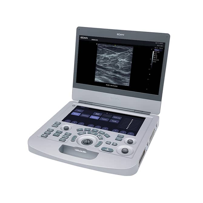 Edan Acclarix AX3 Compact Color Doppler Ultrasound System - Asclepius