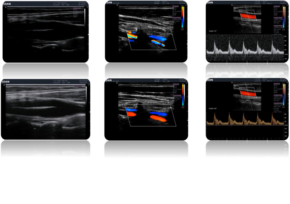 Edan Acclarix LX9 Diagnostic ultrasound system - Asclepius