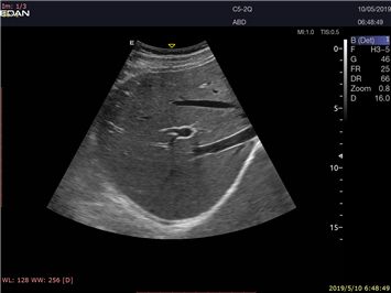 Edan Acclarix LX9 Diagnostic ultrasound system - Asclepius