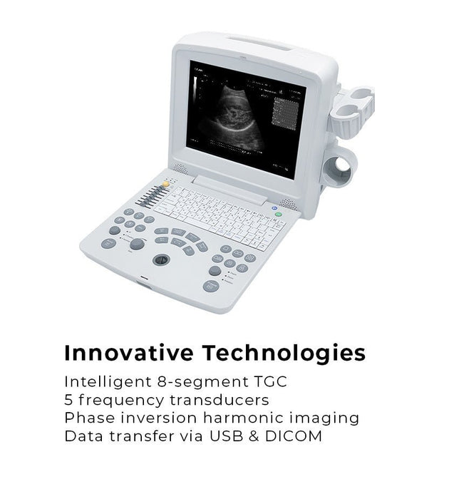 Edan DUS 60 Digital Ultrasonic Diagnostic Imaging System - Asclepius