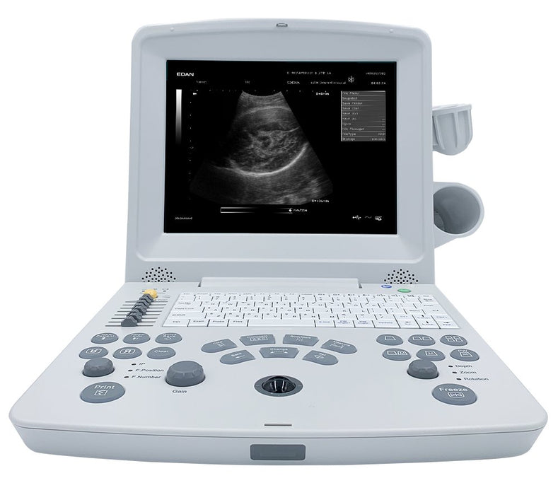 Edan DUS 60 Digital Ultrasonic Diagnostic Imaging System - Asclepius