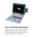 Edan U50 Prime Diagnostic Ultrasound System - Asclepius