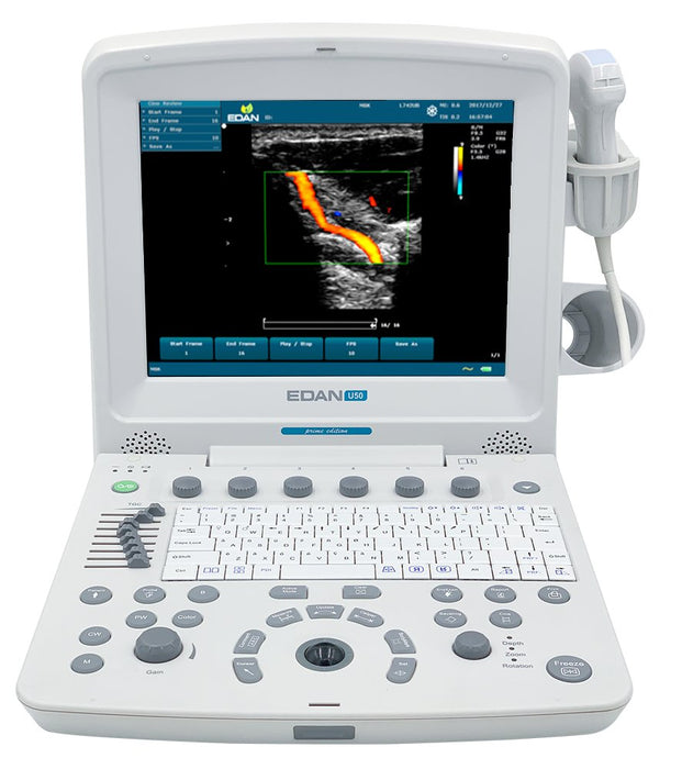 Edan U50 Prime Diagnostic Ultrasound System - Asclepius