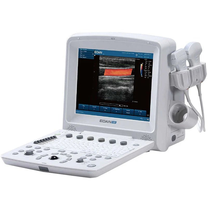 Edan U50 Prime Diagnostic Ultrasound System - Asclepius