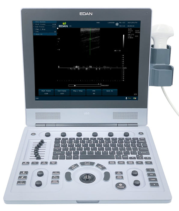 Edan U60 Color Doppler Ultrasound - Asclepius