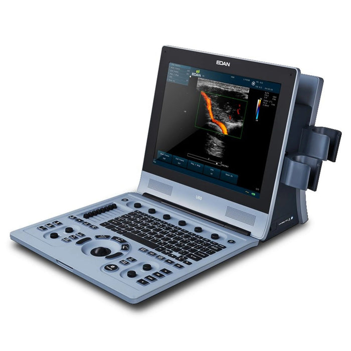 Edan U60 Color Doppler Ultrasound - Asclepius