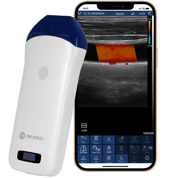 Linear Pro Portable Ultrasound Scanner – 128 - Element, HD Vascular Imaging, Wireless, Compatible with Windows, Android, iOS - Asclepius