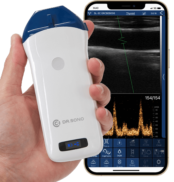 Linear Pro Portable Ultrasound Scanner – 128 - Element, HD Vascular Imaging, Wireless, Compatible with Windows, Android, iOS - Asclepius