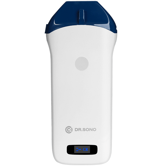 Linear Pro Portable Ultrasound Scanner – 128 - Element, HD Vascular Imaging, Wireless, Compatible with Windows, Android, iOS - Asclepius