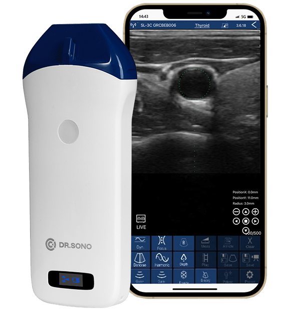 Linear Pro Portable Ultrasound Scanner – 128 - Element, HD Vascular Imaging, Wireless, Compatible with Windows, Android, iOS - Asclepius