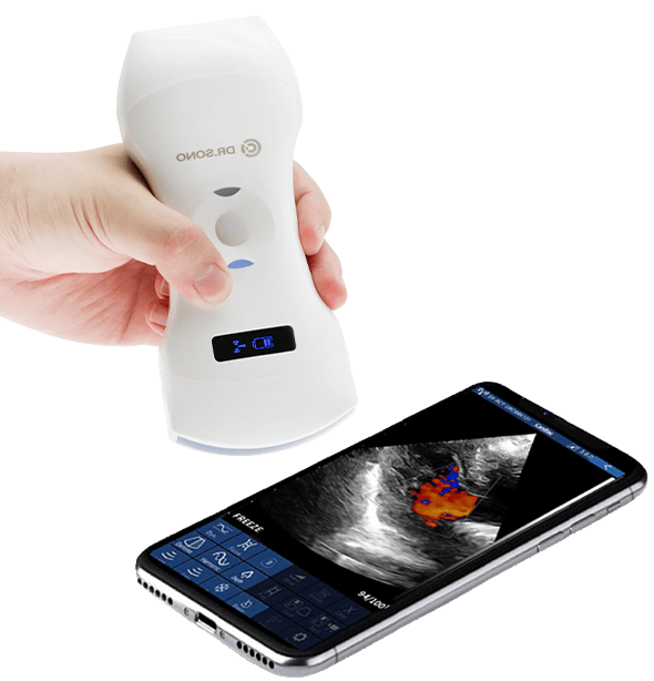 Tri - Scan Max Portable Ultrasound Scanner – 3 - in - 1 Probe, Full Body Scan, Wireless, Compatible with Windows, Android, iOS - Asclepius