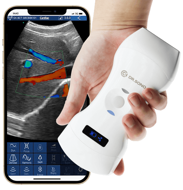 Tri - Scan Max Portable Ultrasound Scanner – 3 - in - 1 Probe, Full Body Scan, Wireless, Compatible with Windows, Android, iOS - Asclepius