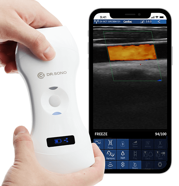 Tri - Scan Max Portable Ultrasound Scanner – 3 - in - 1 Probe, Full Body Scan, Wireless, Compatible with Windows, Android, iOS - Asclepius