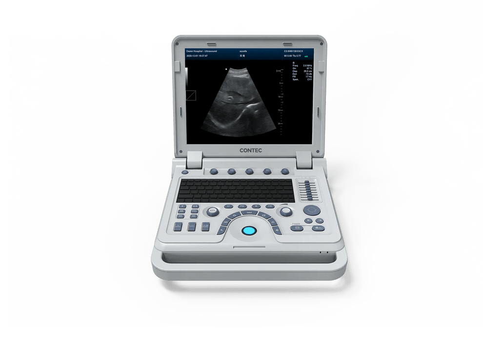 VET CONTEC CMS600P2PLUS - VET B - ultrasound scanner with convex probe - Asclepius