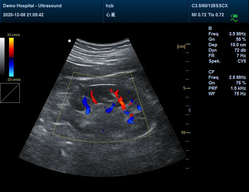 Veterinary Color Doppler CMS1700A - VET Ultrasound Scanner - Asclepius