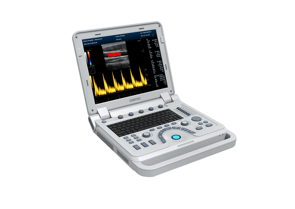 Veterinary Color Doppler CMS1700A - VET Ultrasound Scanner - Asclepius