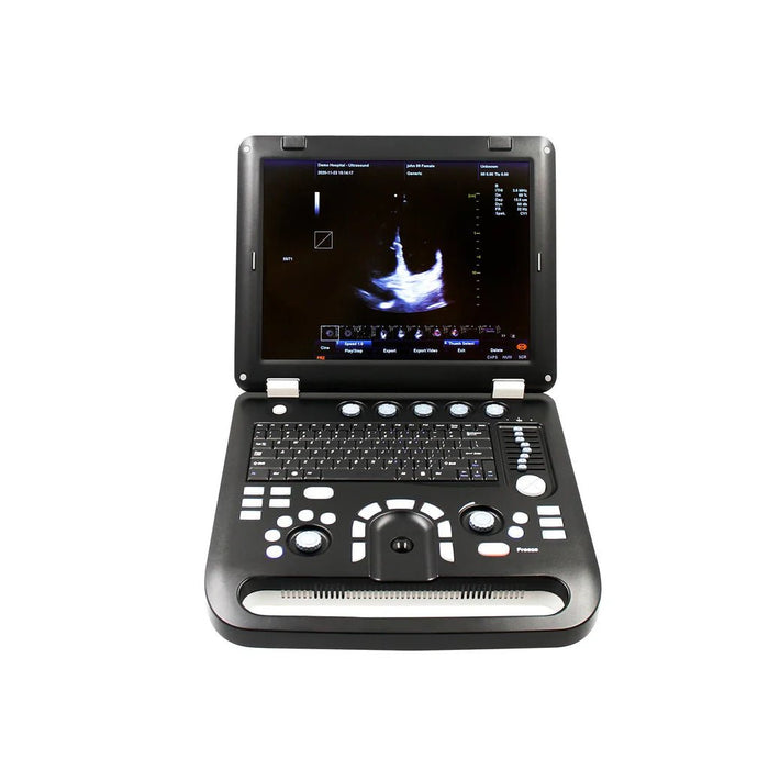 Veterinary use Color Doppler CMS1700C - VET Portable Ultrasound Scanner animals with Probe - Asclepius